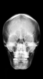 screenshoot for X-ray Scanner Prank