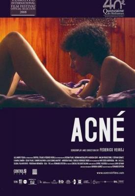 poster for Acne 2008